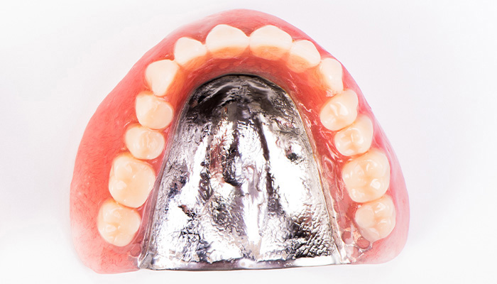 金属床義歯（精密デンチャー）